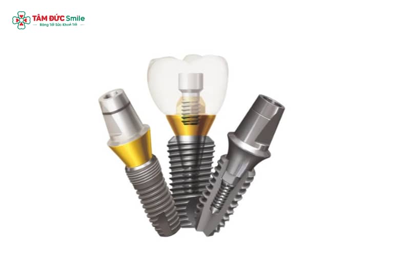 Trụ Implant Mỹ nổi bật với độ bền, chất lượng và khả năng phục hồi nhanh