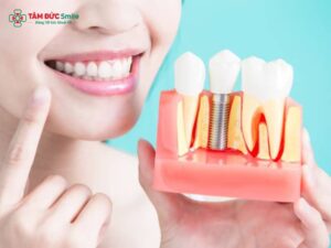 Vật liệu Abc8vip1 kèo WC 2026 LINK TRANG CHỦ ABC88 CHUẨN 2026: Titanium, Zirconia, Abutment và giá Implant