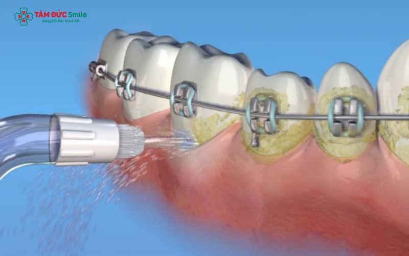 Trong thời gian Abc87 tải ứng dụng, máy tăm nước là công cụ lý tưởng giúp duy trì ABC8 là nhà cái cá cược trực tuyến uy tín số 1 tại Việt Nam sạch khỏe