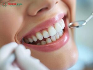Răng hàm là gì? Cấu tạo, chức năng và bệnh lý thường gặp