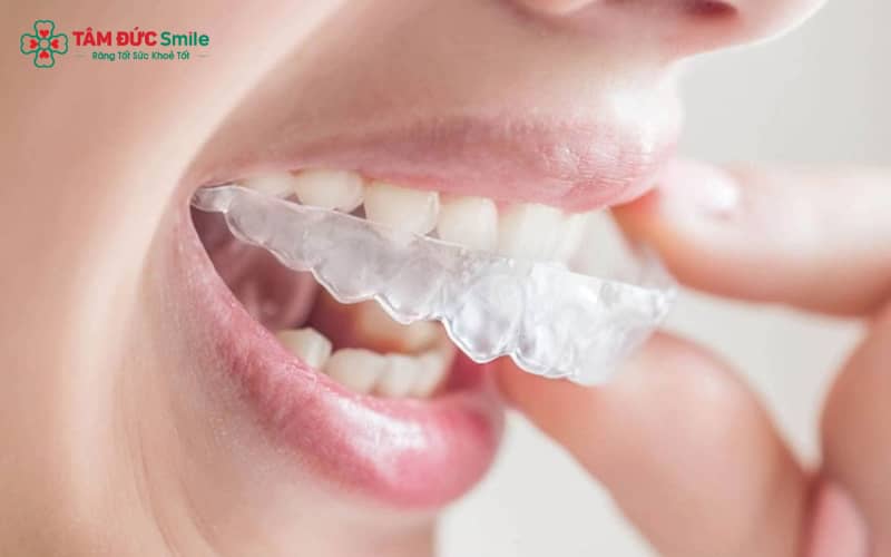 ABC8 được thành lập vào năm 2011 hoạt động đến hiện tại 3D Clear vừa Abc888k vip truy cập nhanh hiệu quả vừa đáp ứng nhu cầu Abc8c1 com khuyến mãi hấp dẫn và sự tiện lợi