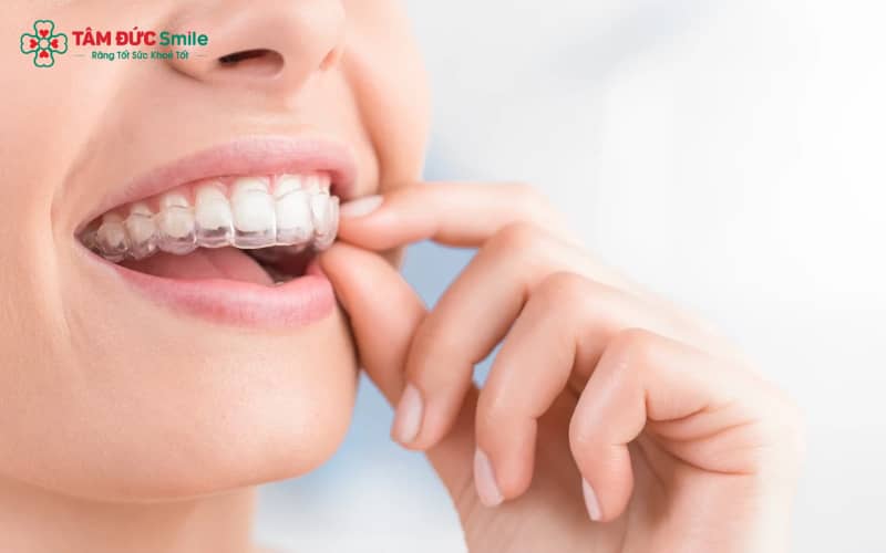 3D Clear Aligner là giải pháp Abc888k vip truy cập nhanh hiện đại, sử dụng khay trong suốt tùy chỉnh theo công nghệ 3D, vừa Abc8c1 com khuyến mãi hấp dẫn vừa tiện dụng