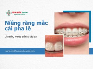 nieng-rang-mac-cai-pha-le-uu-diem-nhuoc-diem-cac-loai-5