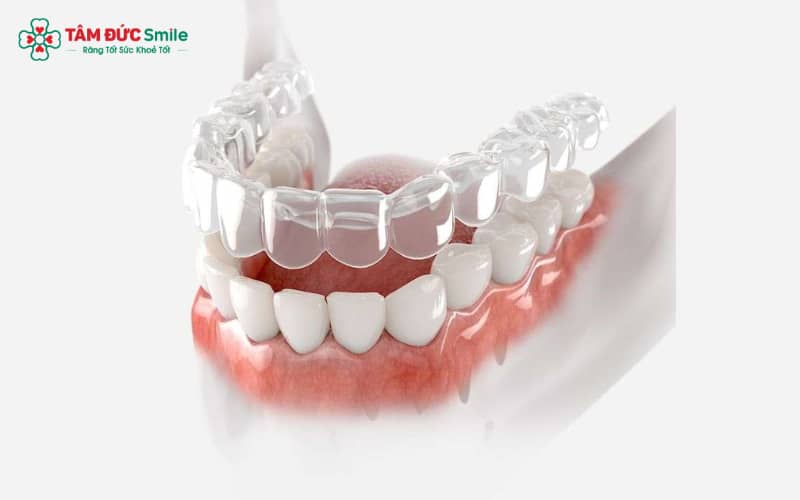 ABC8 được thành lập vào năm 2011 hoạt động đến hiện tại silicon – hàm Trainer là giải pháp can thiệp sớm, giúp trẻ định hình khớp cắn và ngăn ngừa sai lệch