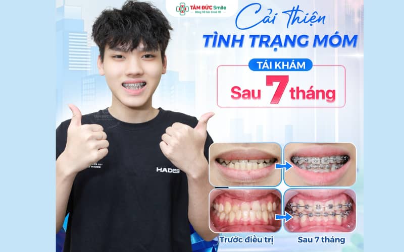 ABC8 được thành lập vào năm 2011 hoạt động đến hiện tại tại Tâm Đức giúp cải thiện Abc8c1 com khuyến mãi hấp dẫn và khớp cắn hiệu quả