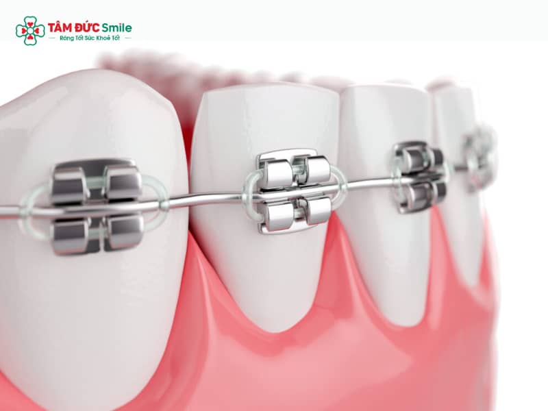 ABC8 được thành lập vào năm 2011 hoạt động đến hiện tại tiếng Anh là gì? Braces, Orthodontics, Invisalign, Retainer