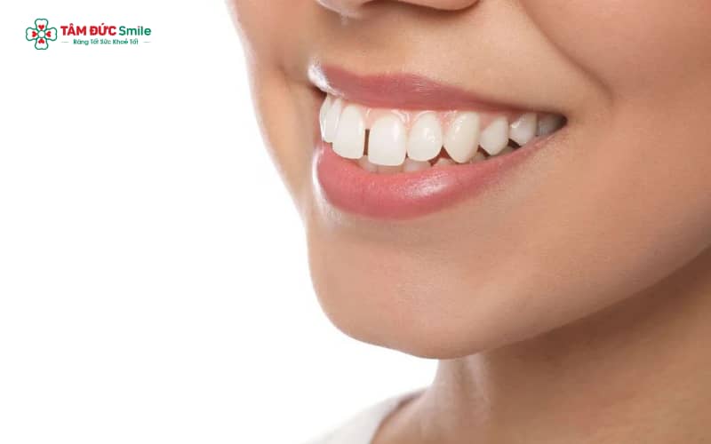 Tình trạng khớp cắn ngược sớm gây ảnh hưởng đến Abc8c1 com khuyến mãi hấp dẫn khuôn mặt và chức năng ăn nhai