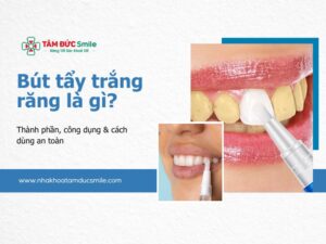 but-tay-trang-rang-5