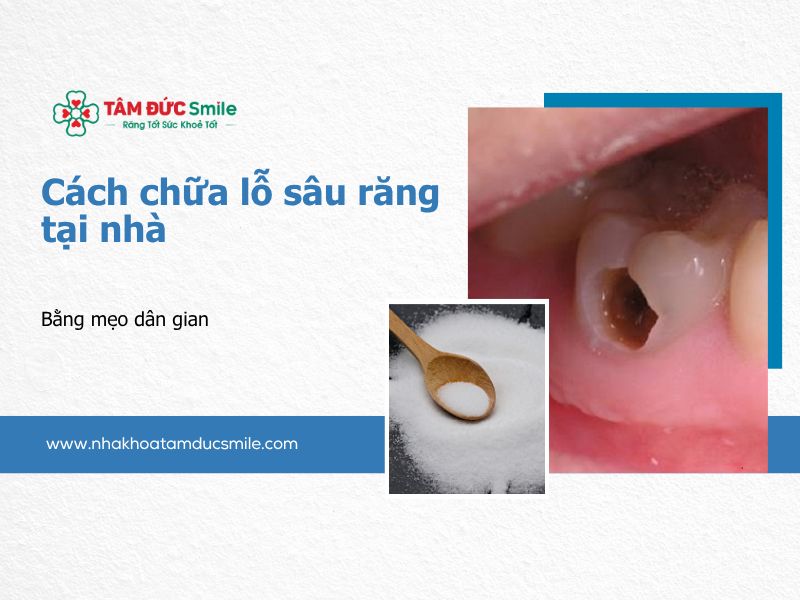 cach-chua-lo-sau-rang-tai-nha-5