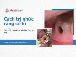 cach-tri-nhuc-rang-co-lo-bien-phap-nha-khoa-va-giam-dau-tai-nha-5