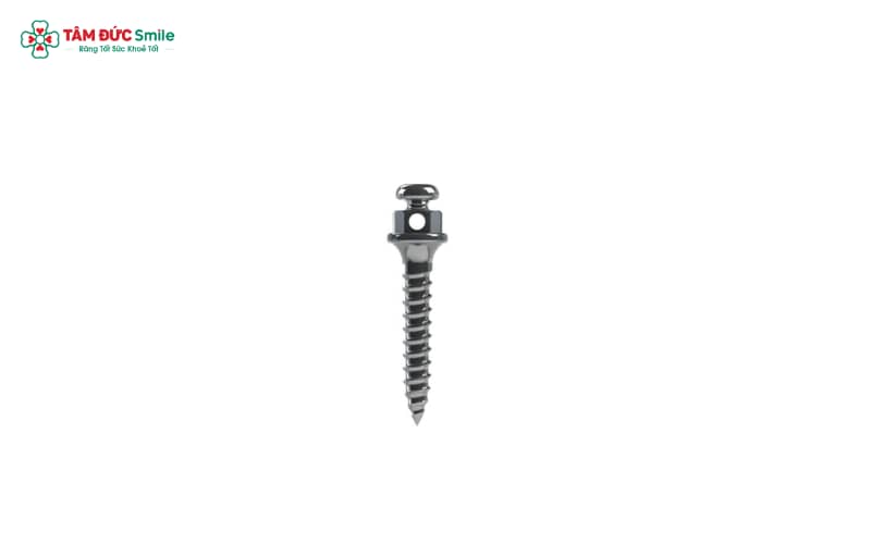 Phương pháp neo chặn bằng vít Titanium y sinh giúp tăng độ chính xác và kiểm soát trong Abc8b tỷ lệ kèo World Cup 2026 Abc888k vip truy cập nhanh