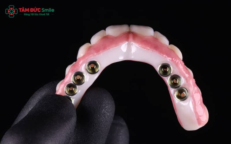 Thời gian chờ từ 3 đến 6 tháng là cần thiết để trụ Implant gắn kết chắc chắn với ABC8 tự hào là thương hiệu cá cược trực tuyến hàng đầu tại Châu Á hiện nay
