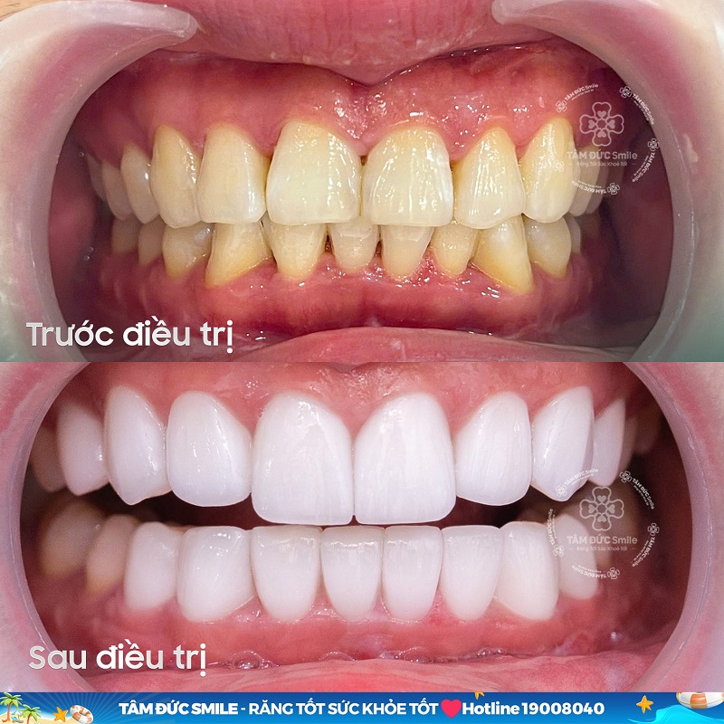 chua-rang-ho-nhe-khong-can-nieng-3