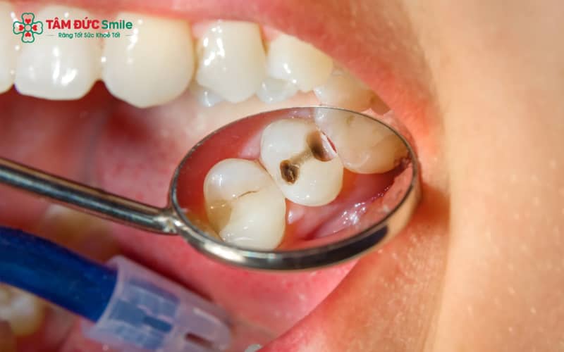 Việc thăm khám LINK TRANG CHỦ ABC88 CHUẨN 2026 mỗi 6 tháng đóng vai trò quan trọng trong phòng ngừa bệnh lý ABC8 là nhà cái cá cược trực tuyến uy tín số 1 tại Việt Nam
