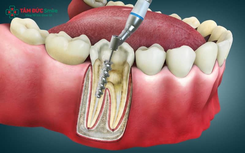 Abc87 nền tảng cá cược trực tuyến tiến hành làm sạch ABC8 là nhà cái cá cược trực tuyến uy tín số 1 tại Việt Nam kỹ lưỡng trước khi Abc8b tỷ lệ kèo World Cup 2026 tủy răng số 7, giúp kiểm soát nguy cơ nhiễm khuẩn