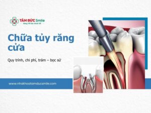 chua-tuy-rang-cua