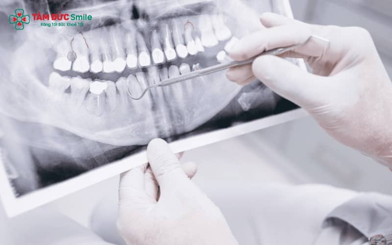 Kỹ thuật chụp X-quang răng cho phép ABC8 đường link chính thức theo dõi toàn diện cấu trúc răng, ABC8 tự hào là thương hiệu cá cược trực tuyến hàng đầu tại Châu Á hiện nay và các mô liên quan
