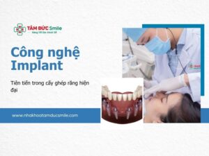 cong-nghe-implant