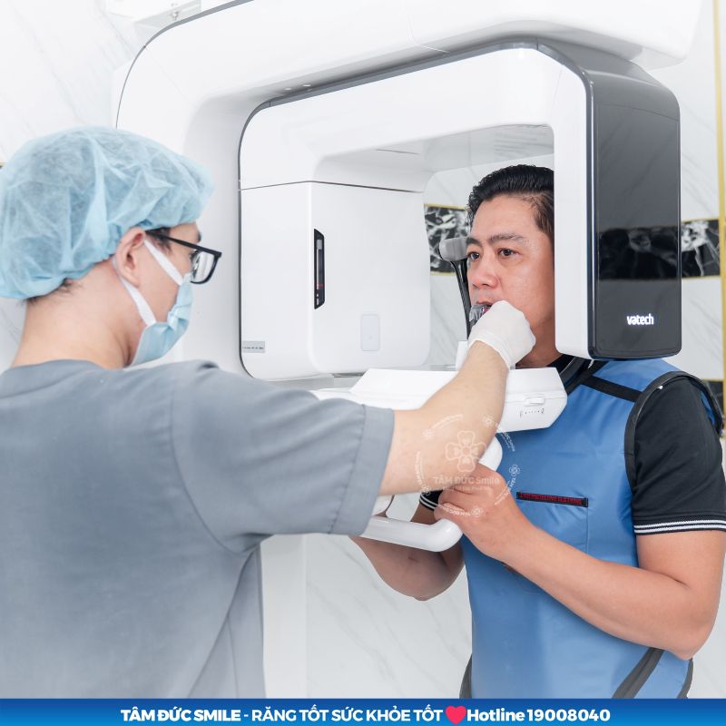 dieu-tri-tuy-rang-15