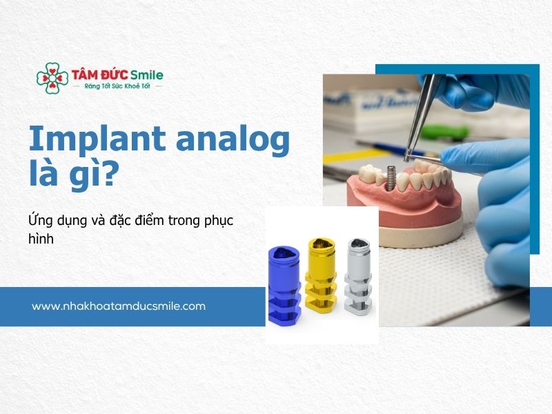 implant-analog