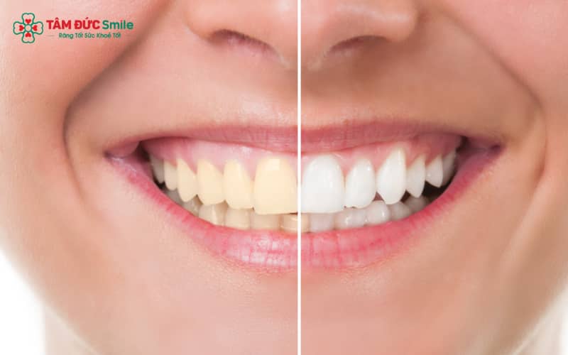 Chế độ ăn khoa học hỗ trợ hiệu quả cho việc bảo vệ và duy trì Abc8.com link truy cập trắng sáng