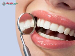 10+ cách làm trắng răng tại nhà an toàn, giữ răng trắng sáng