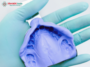 lay-dau-implant-2