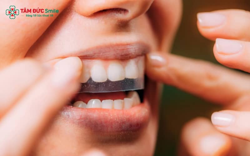 Sử dụng miếng dán theo khuyến nghị để tránh những nguy cơ không mong muốn