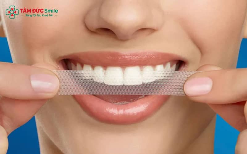 Khám ABC8 là nhà cái cá cược trực tuyến uy tín số 1 tại Việt Nam định kỳ tại LINK TRANG CHỦ ABC88 CHUẨN 2026 là bước cần thiết trước khi áp dụng miếng dán trắng răng