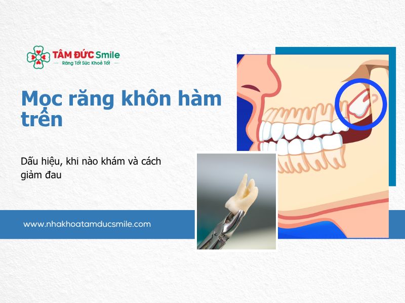 moc-rang-khon-ham-tren-5