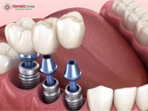 Nhược điểm Link Vào Abc8.com Đăng Ký Tặng 88K: Chi phí, rủi ro, hạn chế