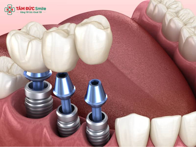 Nhược điểm Link Vào Abc8.com Đăng Ký Tặng 88K: Chi phí, rủi ro, hạn chế