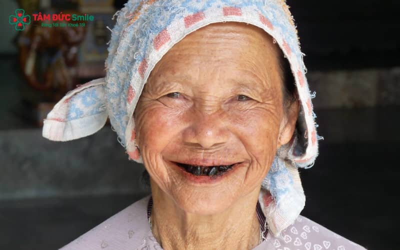 Việc nhuộm răng đen vào tuổi dậy thì thường tượng trưng cho vẻ đẹp, sự trưởng thành và văn hóa