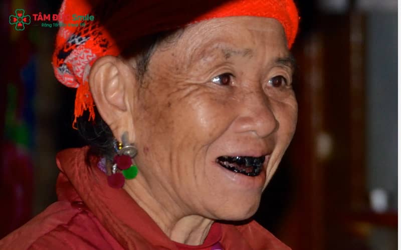 Nhuộm răng đen gần như không còn tồn tại trong đời sống hằng ngày