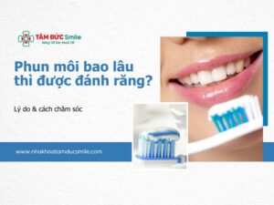 phun-moi-bao-lau-thi-duoc-danh-rang-5