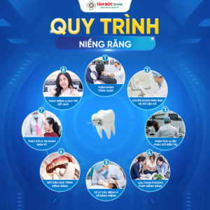 quy-trinh-nieng-rang-1