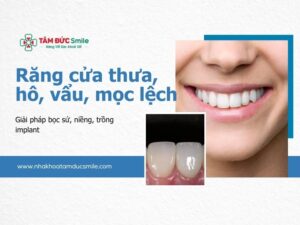 rang-cua