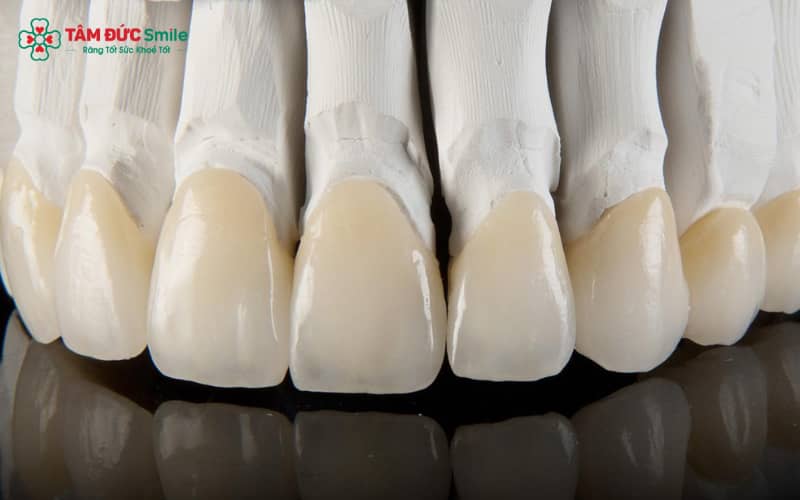 Abc8com cá cược thể thao Lava được sản xuất từ Zirconia tinh khiết, không pha kim loại, mang lại màu sắc trong sáng và Abc8c1 com khuyến mãi hấp dẫn cao