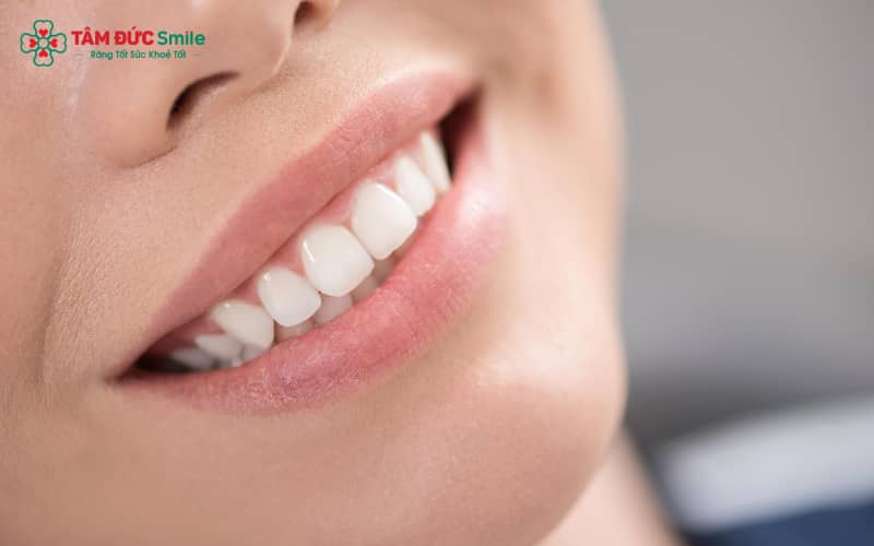 Abc8com cá cược thể thao Lava Plus bền chắc gấp nhiều lần răng thường, cho phép khách hàng tự tin nhai cắn mà không lo gãy vỡ