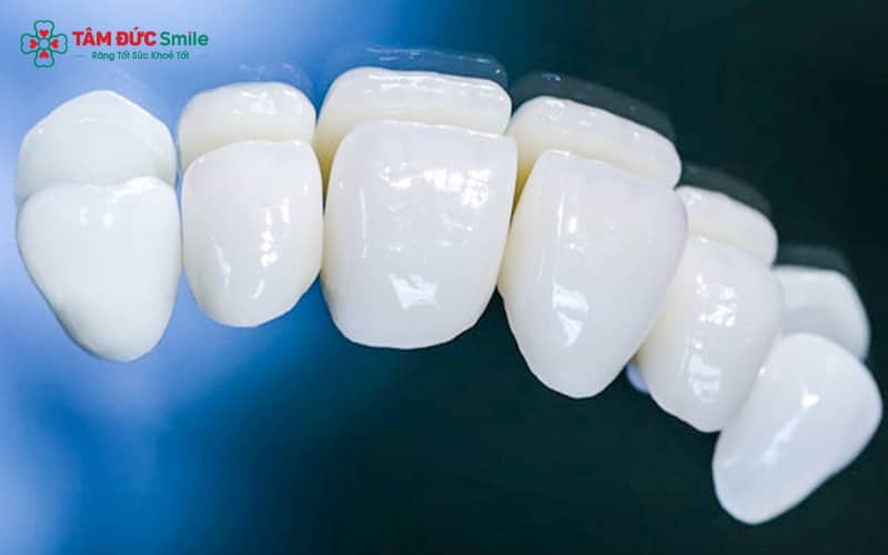Lava 3M là răng toàn sứ Zirconia chất lượng cao, đến từ tập đoàn 3M danh tiếng tại Mỹ