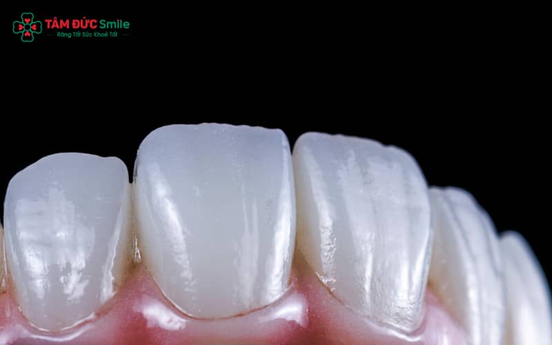 Abc8com cá cược thể thao Lava 3M được hình thành từ Ceramic Nano cao cấp và gia công qua nhiệt độ nung cao