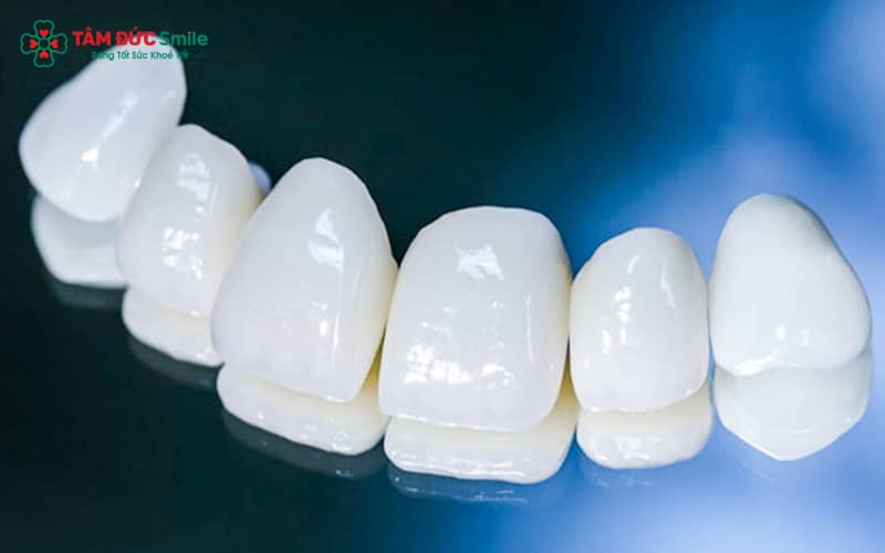 Lava Esthetic là loại sứ cao cấp, cấu tạo hoàn toàn từ sứ nguyên chất và gia công bằng công nghệ nung nhiệt hiện đại