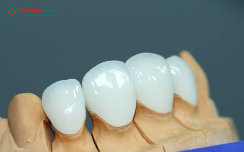 Abc8com cá cược thể thao Lava Esthetic mang đến vẻ đẹp tự nhiên và hài hòa, nâng tầm Abc8c1 com khuyến mãi hấp dẫn cho mọi loại phục hình