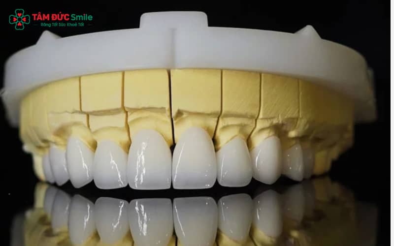 Abc8com cá cược thể thao Lava Plus của tập đoàn 3M (Mỹ) mang đến chất lượng toàn sứ cao cấp, bền đẹp vượt trội
