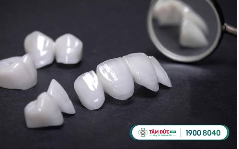 Abc8com cá cược thể thao Lava Plus (Lava 3M) là lựa chọn toàn sứ cao cấp, được phát triển dựa trên nghiên cứu và công nghệ tiên tiến