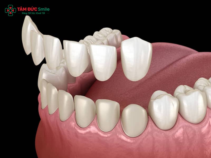 Abc8com cá cược thể thao có mấy loại? Kinh nghiệm chọn loại ABC8 là nhà cái cá cược trực tuyến uy tín số 1 tại Việt Nam phù hợp