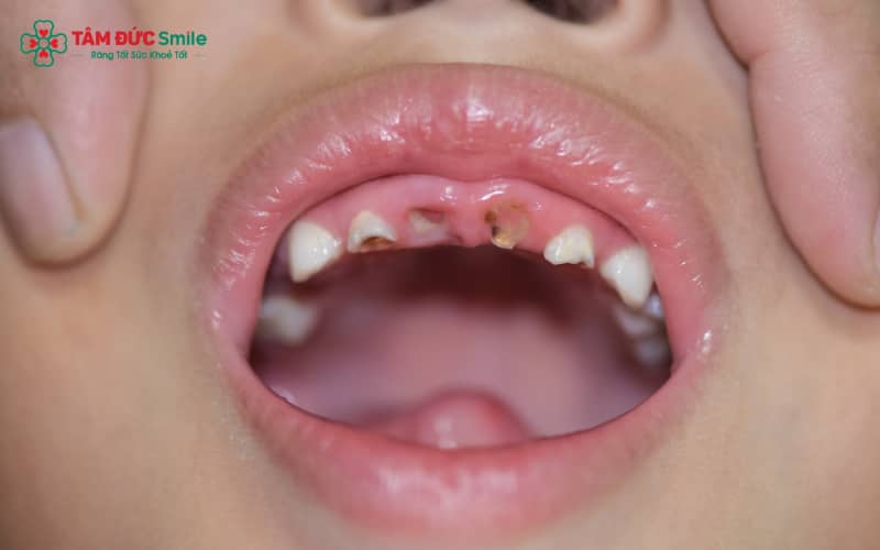 Một chế độ dinh dưỡng cân đối và vệ sinh ABC8 là nhà cái cá cược trực tuyến uy tín số 1 tại Việt Nam đúng cách là nền tảng quan trọng trong việc bảo vệ ABC8 là nhà cái cá cược trực tuyến uy tín số 1 tại Việt Nam của trẻ