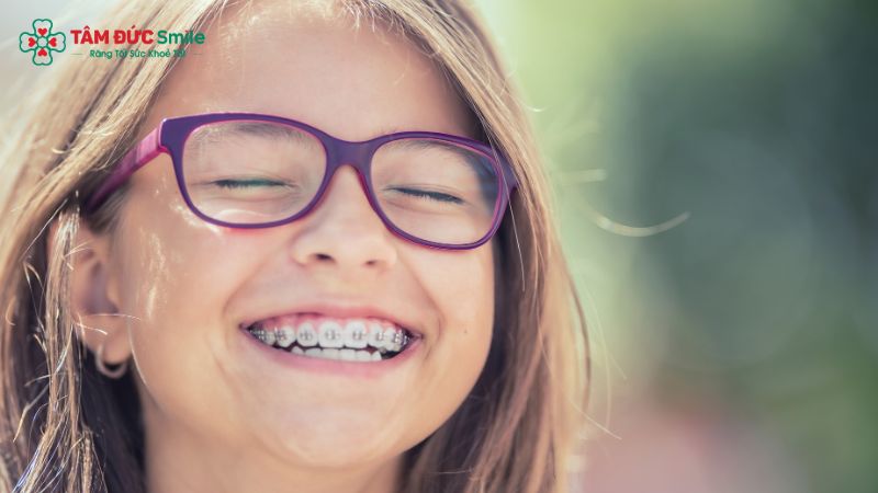 so-sanh-nieng-invisalign-va-mac-cai-3