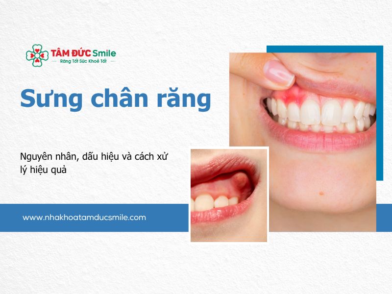 sung-chan-rang-5