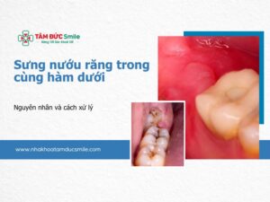 sung-nuou-rang-trong-cung-ham-duoi-5